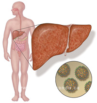 hepatitis2.jpg